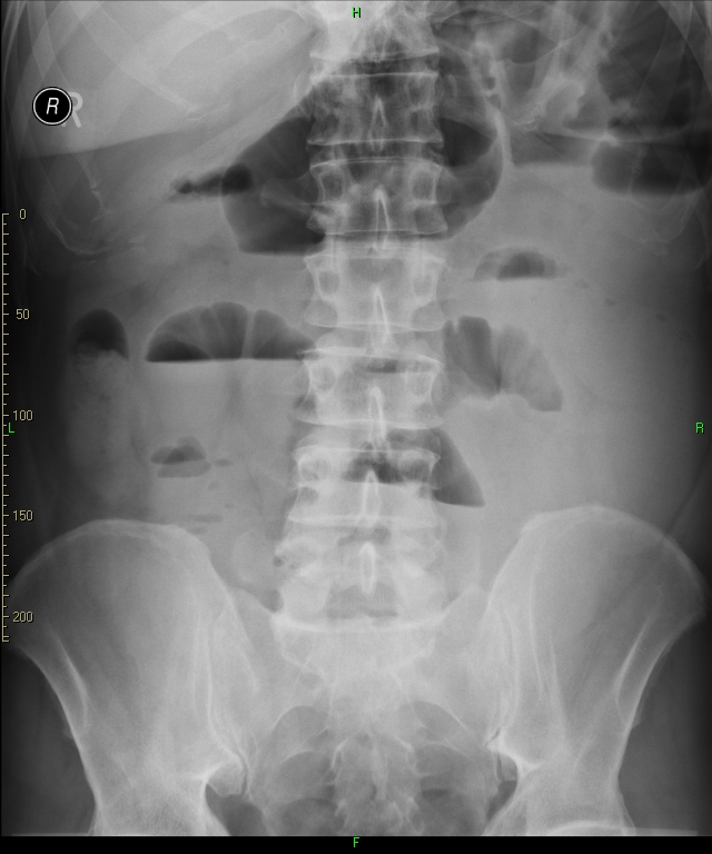 Grey scale imaging (ultrasound)  Radiology Reference Article